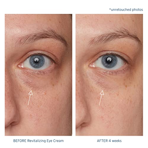 Santo Remedio, Piel Eterna, Revitalizing Eye Cream, Illuminating Eye Cream, Helps Reduce Dark Circles, Contains Marina Algae, Caffeine, Aloe, Hyaluronic Acid, Vitamin E, For All Skin Types, 1 Fl. Oz.