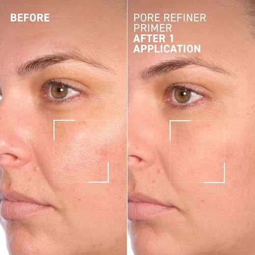 MoistureGlow¢â Plumping Lip Serum