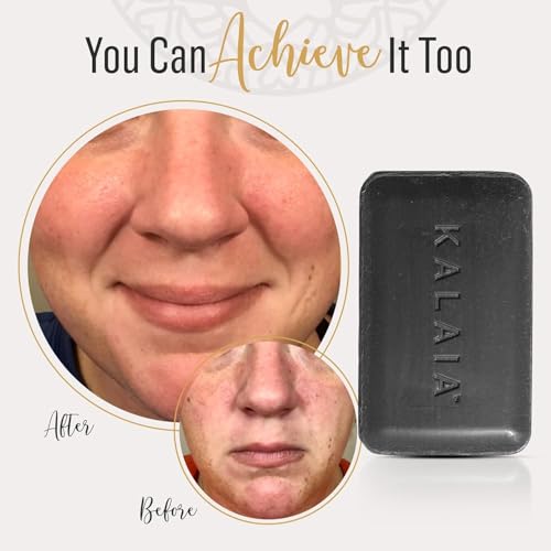 Kalaia - Detox & Balance Charcoal Cleansing Bar, Multi-Use Bar Soap with Activated Charcoal, Hydrating Anti-Acne Face Wash in Soap Bar Form, Removes Makeup and Unclogs Pores, 3 oz/85 g