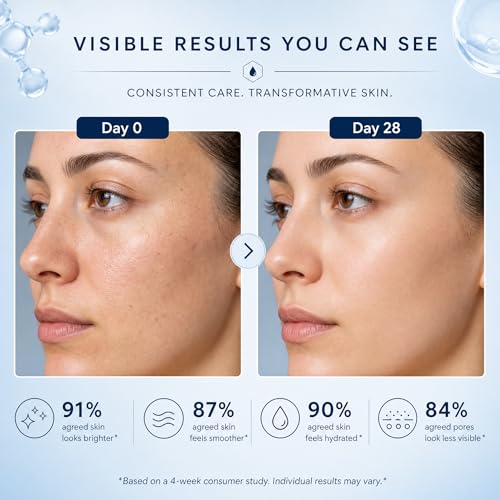 Dark Spot Remover Cream for Face & Body, 1.69 oz
