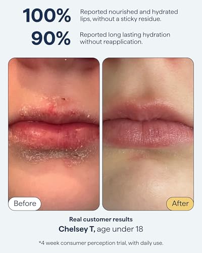 Remedy Science All-In-One Hydrating Lip Treatment with Ceramides - 1 Count