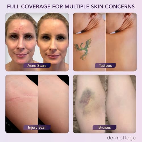 Dermaflage Waterproof Tattoo Concealer Palette - Matte Bronze, 3-Shade Coverage