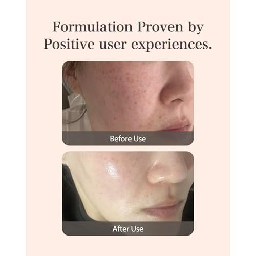 MASTINA Mastic Ampoule Serum Spoid Type Set(Dropper Type, 0.5fl oz, pack of 3), Fermented Mastic Gum. White Mastic Complex 63% + Tranexamic Acid 2% + Niacinamide 5%