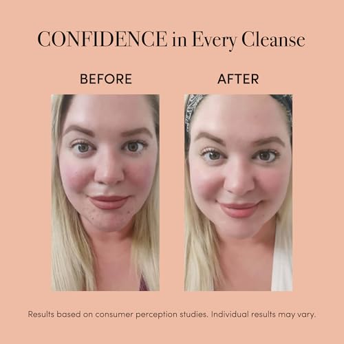 reVive Soniqué Mini Acne Cleanser | Sonic Face Brush with Blue & Red Light