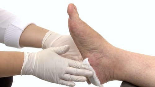 32 oz Non-Acid Callus Softener – Effective Alkaline Treatment