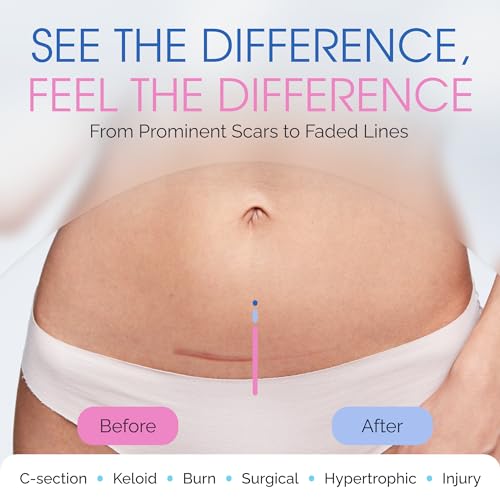 C-Section Silicone Scar Sheets for Cesarean Incision Scars ? Medical Grade Reusable Silicone Scar Strips for Postpartum Recovery ? Clear Breathable Silicone Tape - 7¡±, 8-Pack