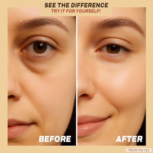 Under Eye Patches with Caffeine, Collagen & Niacinamide (30 Pairs) ? Hydrating Eye Mask for Puffy Eyes, Dark Circles, Wrinkles, and Fine Lines ? Reduces Eye Bags ? formulated in North America
