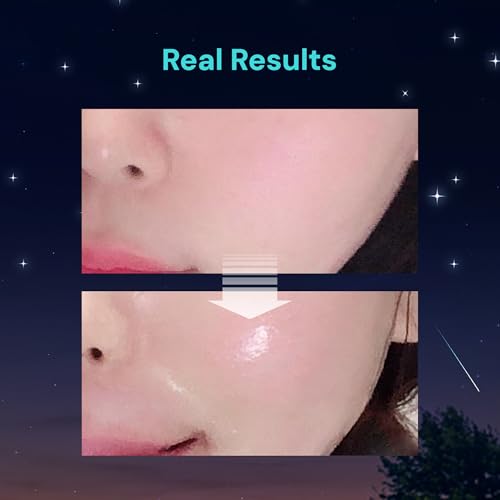 THANKYOU FARMER Saccharomy Brightening Star Mask (10ea) - Phyto Mucin Essence for Glowing, Niacinamide, Fermented Rice, Saccharomyces, Korean Sheet Mask for Dry and Dehydrated Skin (10)