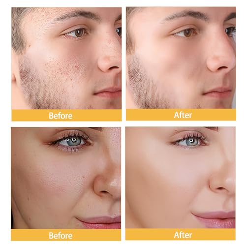 Moisturizer Cream Face Cream with 4% Niacinamide, 3% Tocopherol, Ceramides Boosts Skin Barrier for All Skin Types (3.53oz/100g)