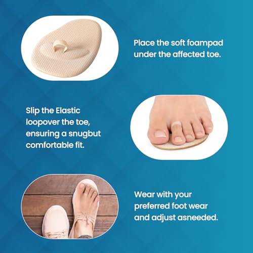 Kimihome 2-Pair Toe Straighteners for Crooked & Hammer Toes, Flexible Comfort, Beige