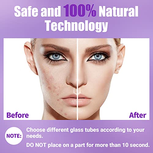 UUPAS High Frequency Facial Wand with 4 Violet Tubes