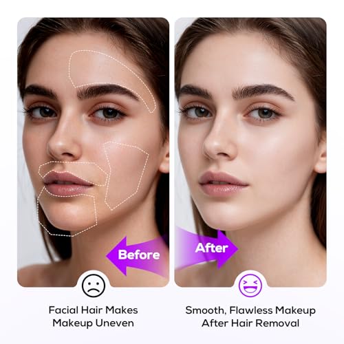 Sonic Dermaplane Razor for Women - Facial Hair Removal with 10 Blades