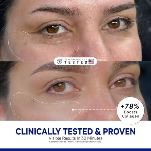 Peptide Under Eye Patches, Firming Eye Patches Instant Reduces Dark Circles and Puffiness, Collagen Under Eye Mask for Bags Treatment, Wrinkles, 24 Pairs, Vegan