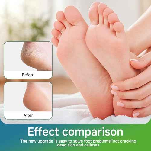 Nano Glass Foot File Callus Remover, Beyond The Cream Foot File,NanoGlass Feet File Professional Hard Skin Remover with Non-Slip Ergonomic Handle (Blue,1Pcs)