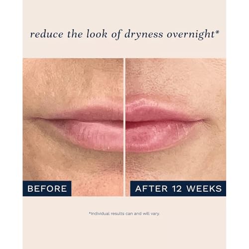 City Beauty City Lips Night Oil - Plumping & Hydrating Lip Treatment