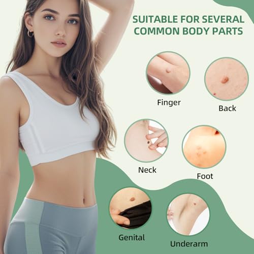 Dual-Size Skin Tag Removal Kit – At-Home Ligation System
