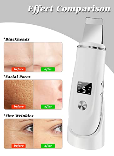 4-in-1 Face Skin Scrubber with USB Charging & Auto Shut-off