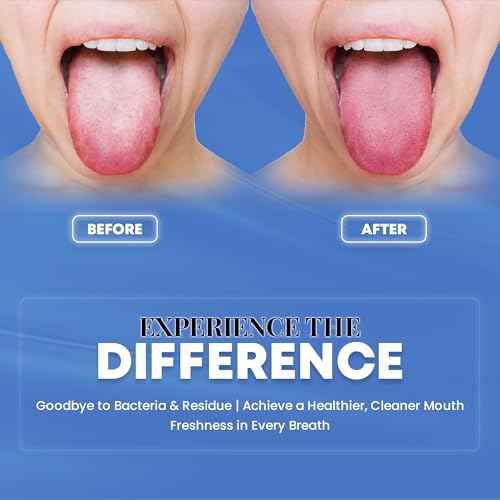 HOKIN Tongue Scraper for Adults with Travel Cases (2Pcs U & Spoon Combo Pack) - 100% Metal Tongue Cleaners, Tough Scrapers for Oral Hygiene