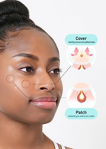 OLIVE YOUNG Care Plus Spot Patch 2 Pack | Hydrocolloid Acne Korean Spot Patch to Cover Zits, Pimples and Blemishes, for Troubled Skin and Face (204 Count - 10mm*144ea + 12mm*60ea)