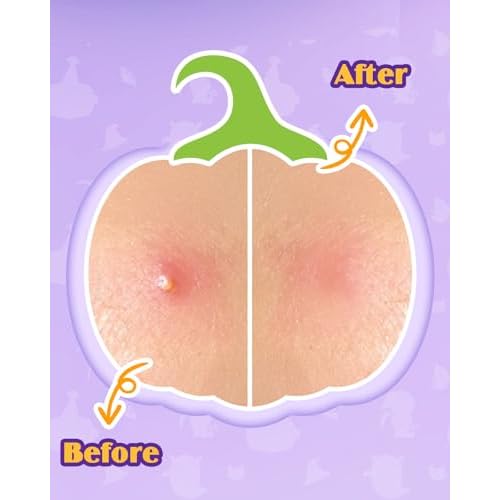 Halloween Acne Pimple Patches Cute - 144 Count Hydrocolloid Pimple Patches for Face, Spot Treatment Stickers w/Salicylic Acid & Tea Tree Oil for Zits and Blemishes, 2 Sizes & 12 Patterns