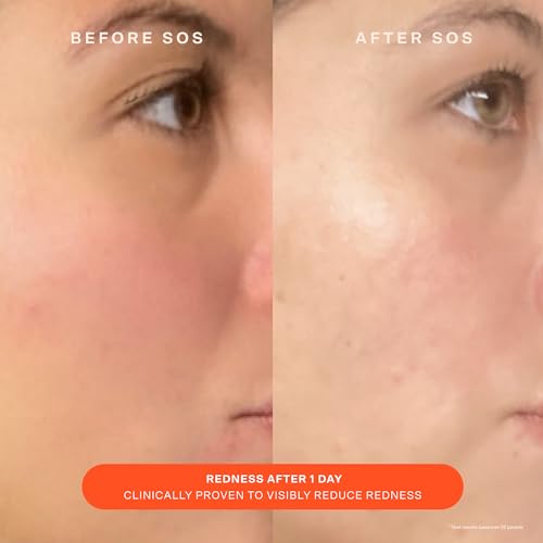 Tower 28 SOS Skin Care Set - Balancing Gel Cleanser (150 ML) + Barrier Recovery Cream (1.86 Oz) - Soothing Face Wash for Sensitive Skin + Hydrating Face Moisturizer with Hyaluronic Acid (2 Count)