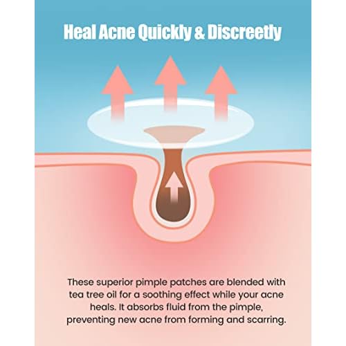 Pimple Patches 420 Counts Three Sizes, Hydrocolloid Patch Invisible with Tea Tree Oil, Acne Patches, Zit Patches for Face, Acne Spot Treatment