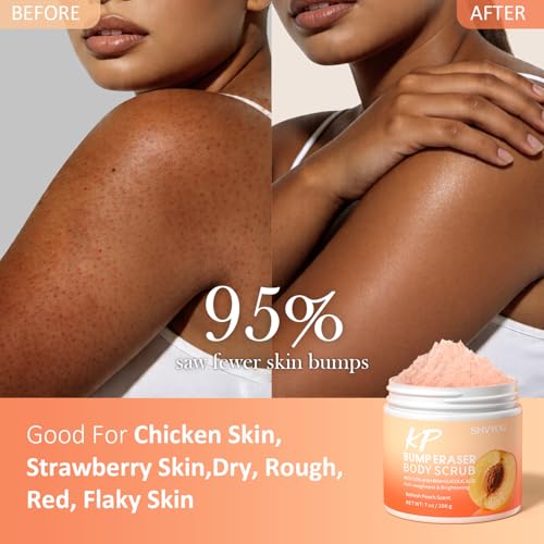 KP Bump Eraser Body Scrub with AHA+BHA & Glycolic Acid