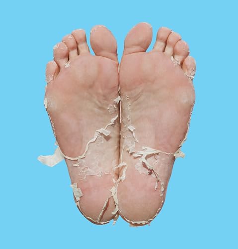 Skin Republic Pedi Peel Max Intense Foot Peeling Mask with AHA - 1 Pair