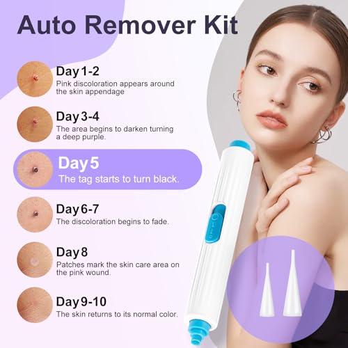 AL-40 Skin Tag & Wart Removal Kit – Professional Home Treatment
