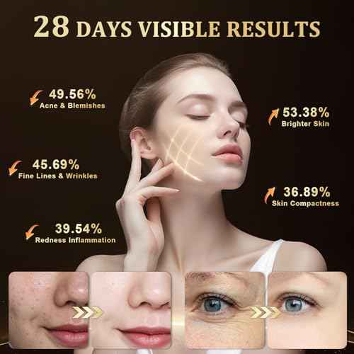 Red Light Therapy for Face, LED Face Mask Light Therapy, Omnilux Red Light Therapy Mask for Wrinkles, Acne, Skin Rejuvenation, 320 LEDs, 3 Modes, 10-Min Auto Off, Eye Protection Included