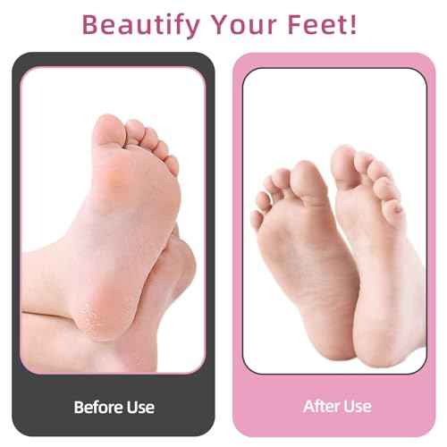 4.8IN Longer Electric Foot Callus Remover with 80pcs Sandpaper Discs, Professional Aluminum Callus Remover for Feet, Stepless Speed Control Pedicure Tools for Dead Skin (Pink)