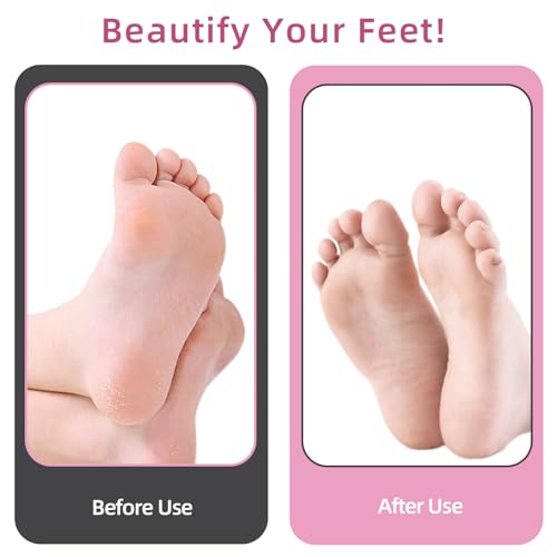 APRELM Professional Electric Foot Callus Remover with 80 Sandpaper Discs