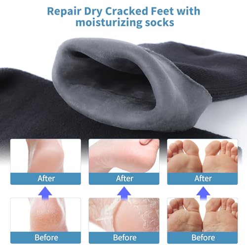 Men's Silicone Moisturizing Socks for Dry Cracked Feet - 2 Pairs (US 9.5-12)