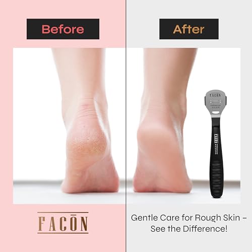 Professional Callus Shaver with 50 Blades - Surgical-Grade Tool for Feet & Hands