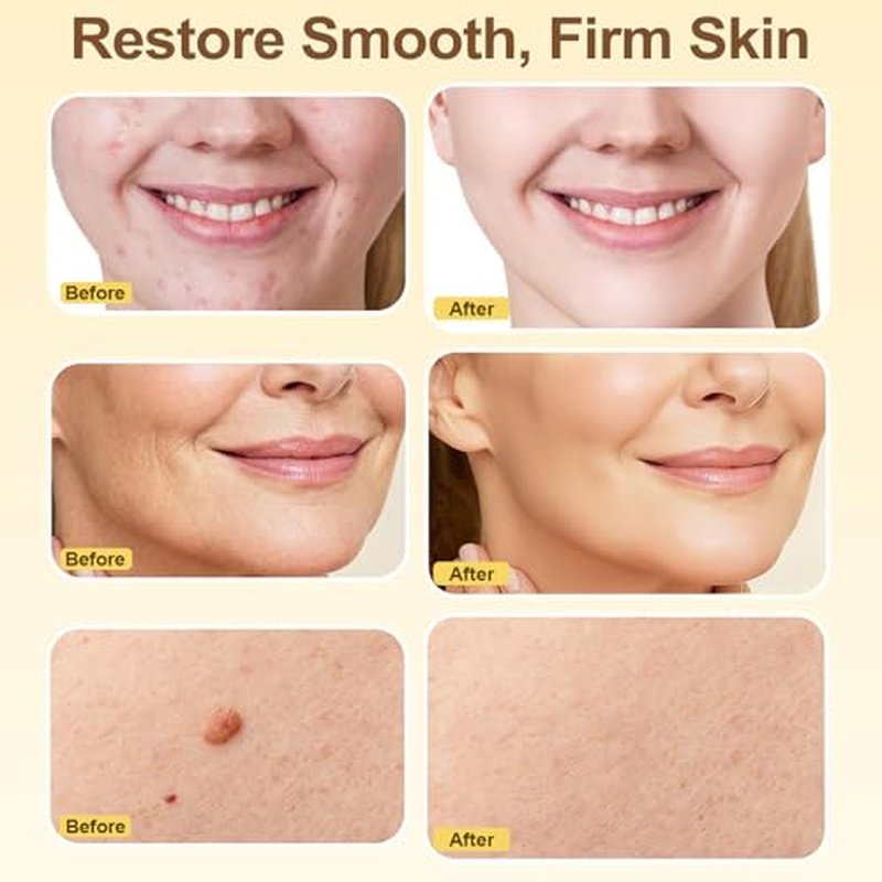2Pcs Bee Venom Skin Treatment Cream, Face Lifting and Firming For Daily Use, Effectively Smoothens the Skin Body Moisturizer, Gentle & Non-irritating Formula Suitable For Whole Body & Skin Types