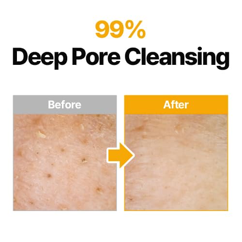 ma:nyo Pure Cleansing Oil - Korean Blackhead Melting Makeup Remover 6.7 fl oz