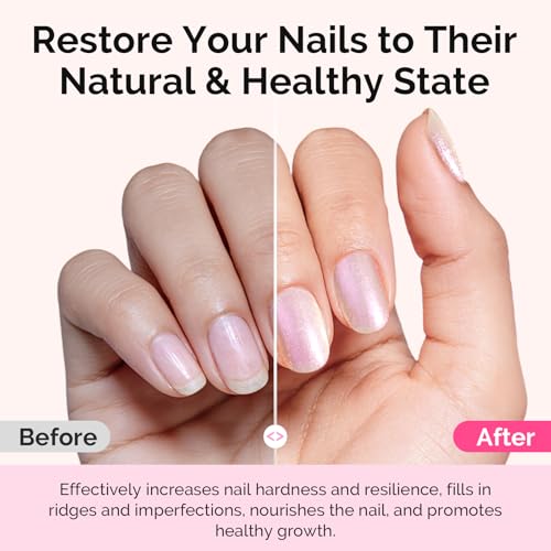 MelodySusie Nail Strengthener & Growth Treatment - Ridge Filling Base Coat 15ml