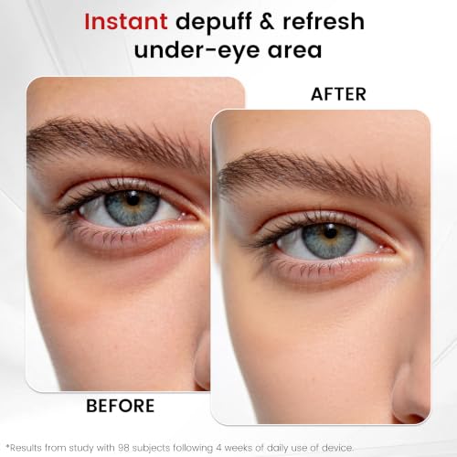 Eye Depuffing Wand - 2-In-1 Cold & Heat Facial Roller