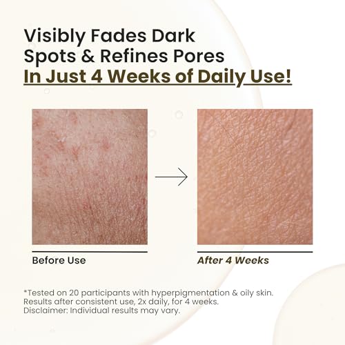 Glow Face Oil ? Retinol Alternative for Dark Spots, Wrinkles & Pores ? Jojoba, Moringa, Rosehip, Sea Buckthorn, Vitamin E ? Anti-Aging Brightening Serum for Glowing Skin