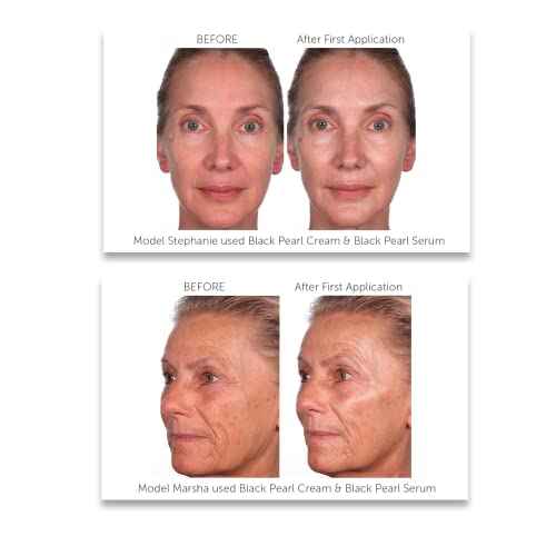Serious Skincare - Black Pearl Deep Wrinkle Decrease Face Serum - Repair Deep Lines & Wrinkles - Increases Skin Hydration & Elasticity - Radiance Boosting for Luminous Glowing Skin 1 Fl. Oz.
