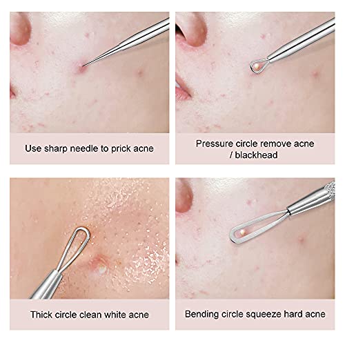 Blackhead Remover Tool 2-in-1 Pimple Extractor - Stainless Steel
