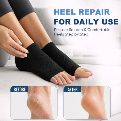 OKbutler Moisturizing Gel Heel Socks for Dry Cracked Feet - 2 Pairs Black