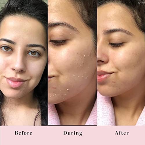 Saturday Skin Rub-A-Dub Refining Peel Gel Facial Cleansing Exfoliating Gels and Hydrating Foam Cleanser Natural Ingredients Anti-aging Makeup Remover and Face Wash