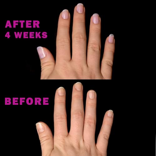 Nail Strengthening Kit - 4-Piece Keratin Treatment for Stronger Nails