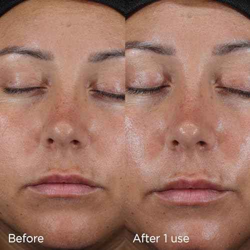 IMAGE Skincare DAILY PREVENTION Ultra Defense Moisturizer, SPF 50 Broad Spectrum Sunscreen, Fragrance Free