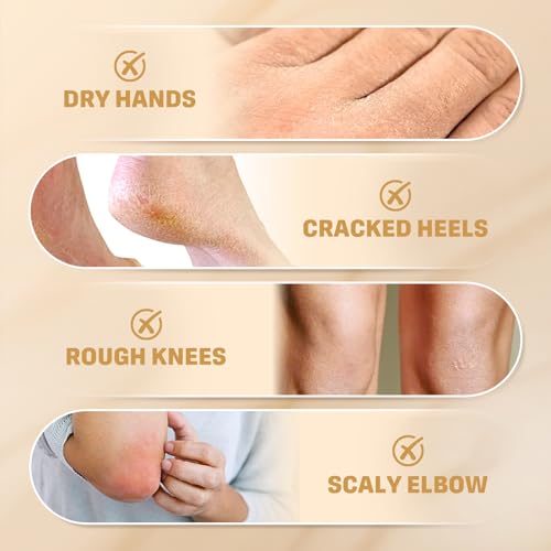 60% Urea Cream for Feet & Hands | Deep Moisturizing, 150g