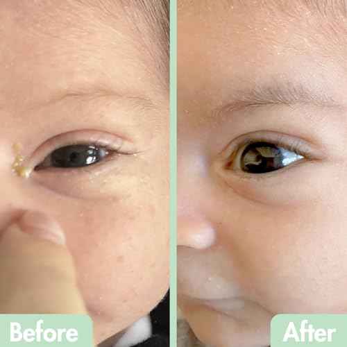 GlamBaby Eye Care - Eye Boogies¢â Eyelid Cleaning Spray | Non-Toxic, Sting-Free & Wipe-Free Formula | Kids' Eyes Clean | Kids Eye Drops Sprayer | Baby Eye Drops Spray | Child Eyelid Cleanser (1 Pack)