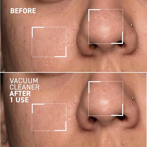 Dr. Brandt Pores No More Vacuum Cleaner - Pore-Purifying Mask to Unclog & Shrink Pores - 1 oz