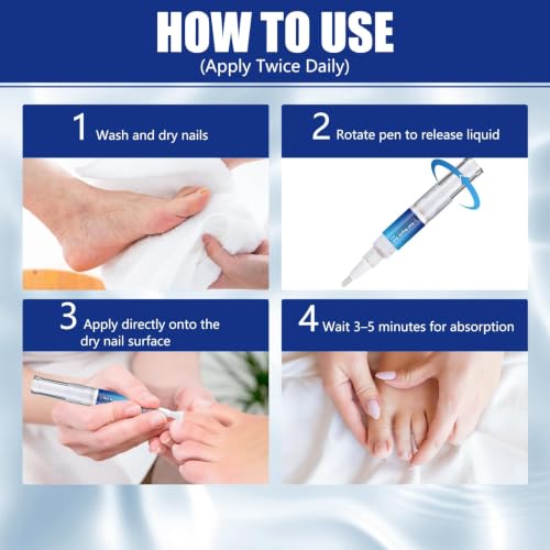 Extra Strength Toenail Fungus Treatment Pen with Tea Tree Oil