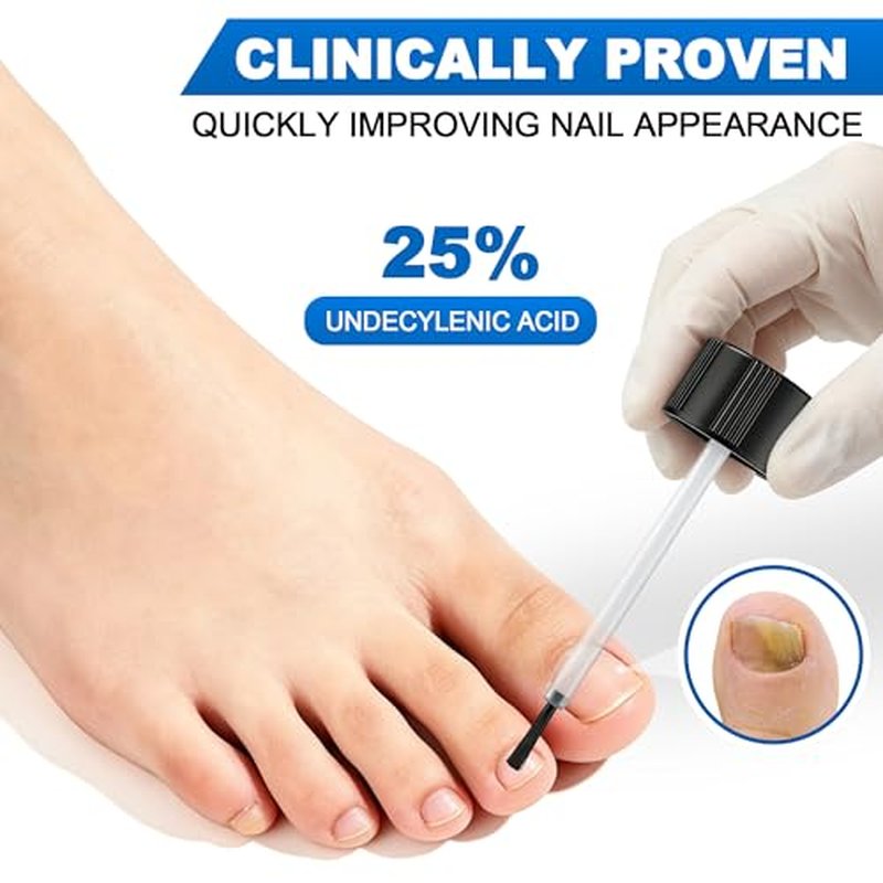 AOUGK Toenail Fungus Treatment - Extra Strength 25% Undecylenic Acid, 30ML